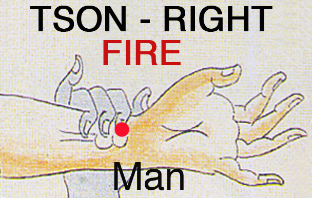 File:Tson right M.jpg