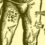 Buddhist Story: Man Wounded by an Arrow