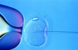 In-vitro fertilisation