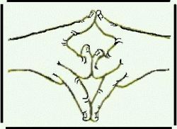 Buddhist Symbols, The Becon Lights to Nibbana by Ven. Dr.Bhikkhu Bodhipala